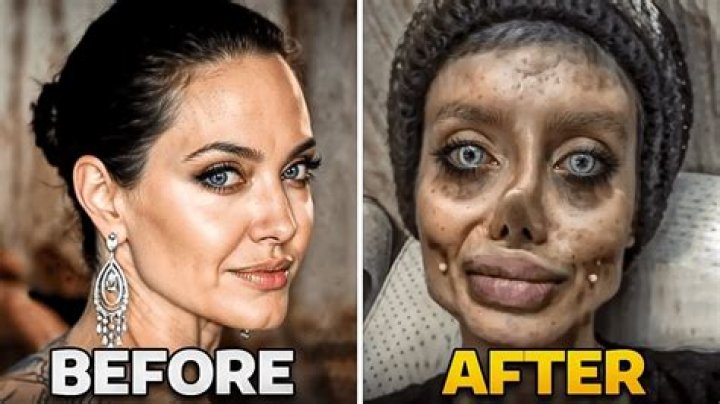 Erykah Badu Plastic Surgery Before And After: What Is Wrong With Her Face?